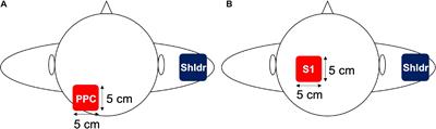 Region-Specific Effects of 10-Hz Transcranial Alternate Current Stimulation Over the Left Posterior Parietal Cortex and Primary <mark class="highlighted">Somatosensory Area</mark> on Tactile Two-Point Discrimination Threshold